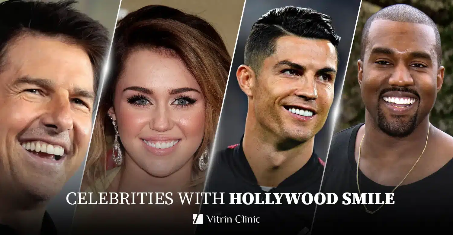 Celebrities with HOLLYWOOD SMILE