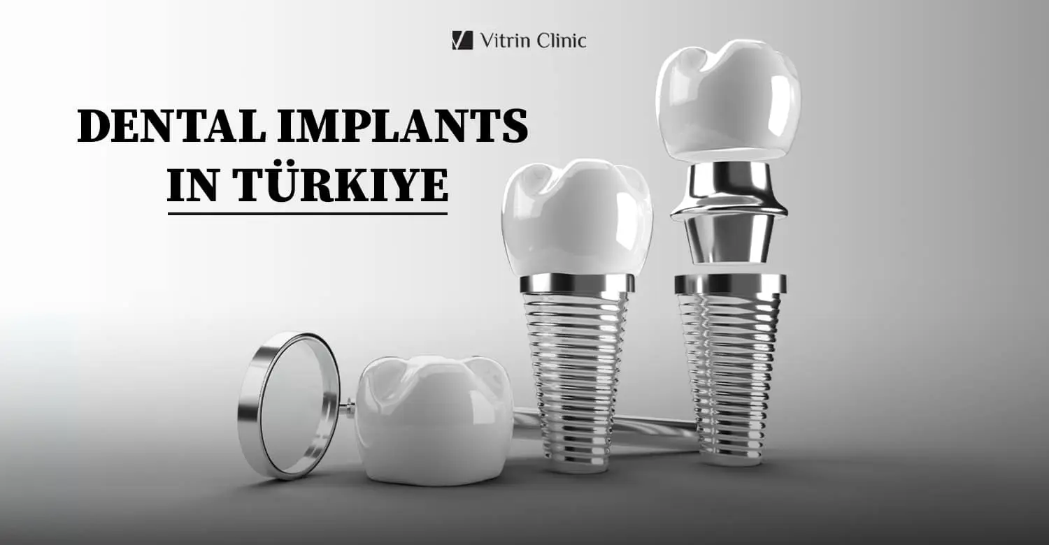 Zahnimplantate in der Türkei
