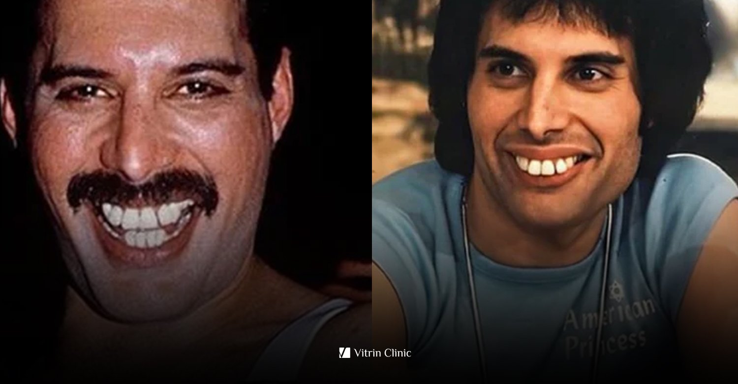 Freddie Mercury