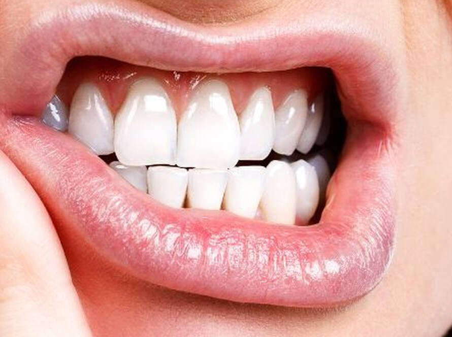 Wisdom Tooth Extraction