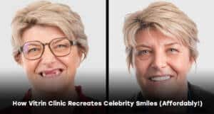 Hoe Vitrin Clinic de glimlach van beroemdheden creëert (voor een betaalbare prijs!)